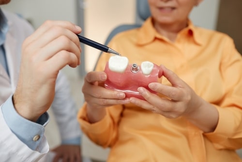 Procedimiento de implantes dentales | Carolina Dental Arts | Carolina del Norte